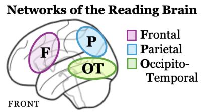 A diagram of the human brain highlighting the Frontal, Parietal, and Occipito-Temporal lobes.