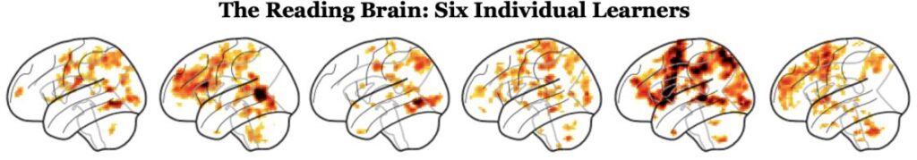 A heat map of six different human brains, each highlighting areas of activity.